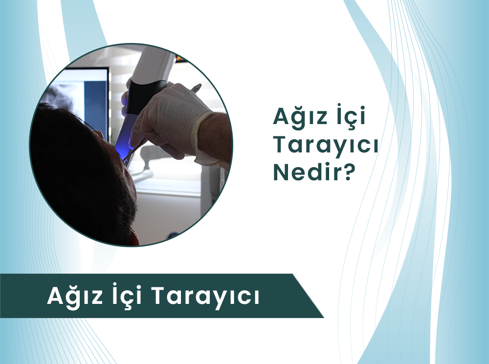 Ağız İçi Tarayıcı Nedir?