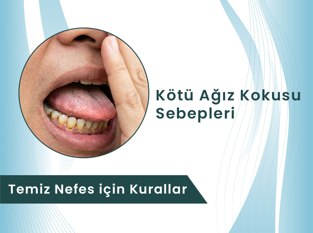 Kötü Ağız Kokusu (Halitozis) Neden Olur? | Dental Rezidans