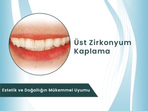 Dental Rezidans Üst zirkonyum gülüş tasarımı uygulaması