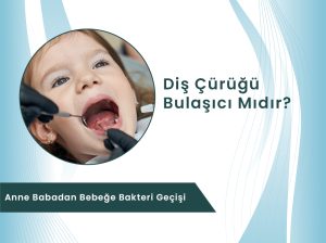 Diş çürüğü bulaşıcı mıdır ve anne babadan bebeğe bakteri geçişi konulu blog kapak görseli - Dental Rezidans