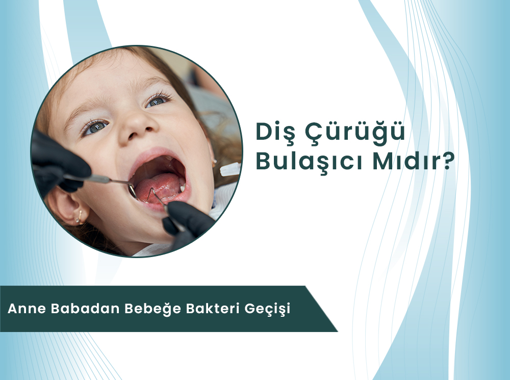 Diş Çürüğü Bulaşıcı Mıdır? Anne Babadan Bebeğe Bakteri Geçişi