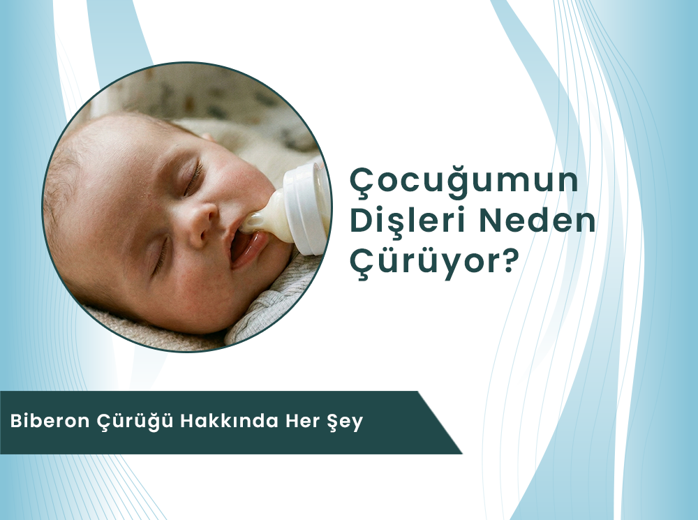 Çocuğumun Dişleri Neden Çürüyor? Biberon Çürüğü Hakkında Her Şey