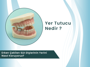 Dental Rezidans pedodonti kliniğinde uygulanan sabit yer tutucu diş maketi ve erken süt dişi çekimi tedavisi