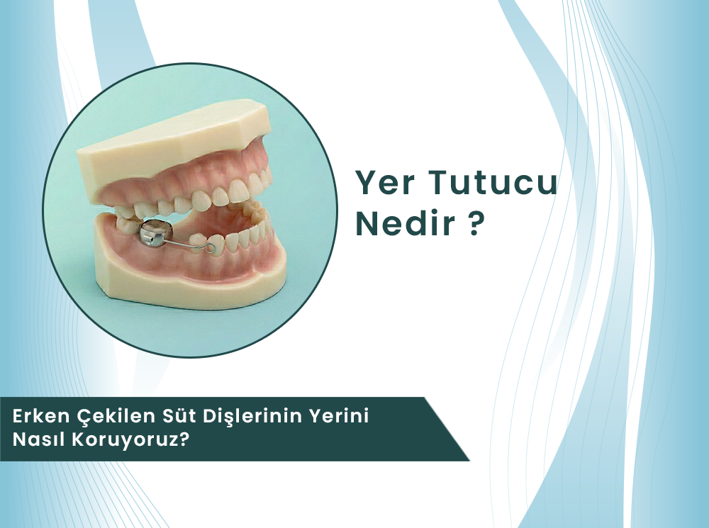 Yer Tutucu Nedir? Erken Çekilen Süt Dişlerinin Yerini Nasıl Koruyoruz? | Dental Rezidans – Pedodonti Bölümü