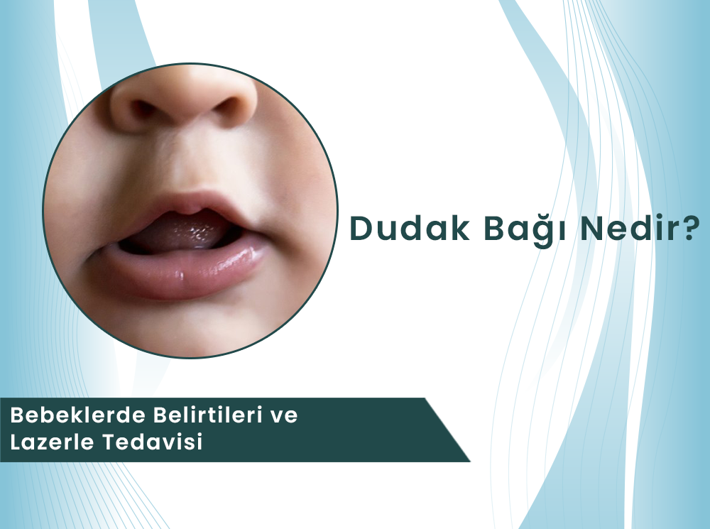 Dudak Bağı (Frenulum) Nedir? Bebeklerde Belirtileri, Zararları ve Lazerle Tedavisi