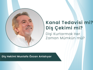 Mustafa Özcan kanal tedavisi mi diş çekimi mi konusunda bilgi veriyor