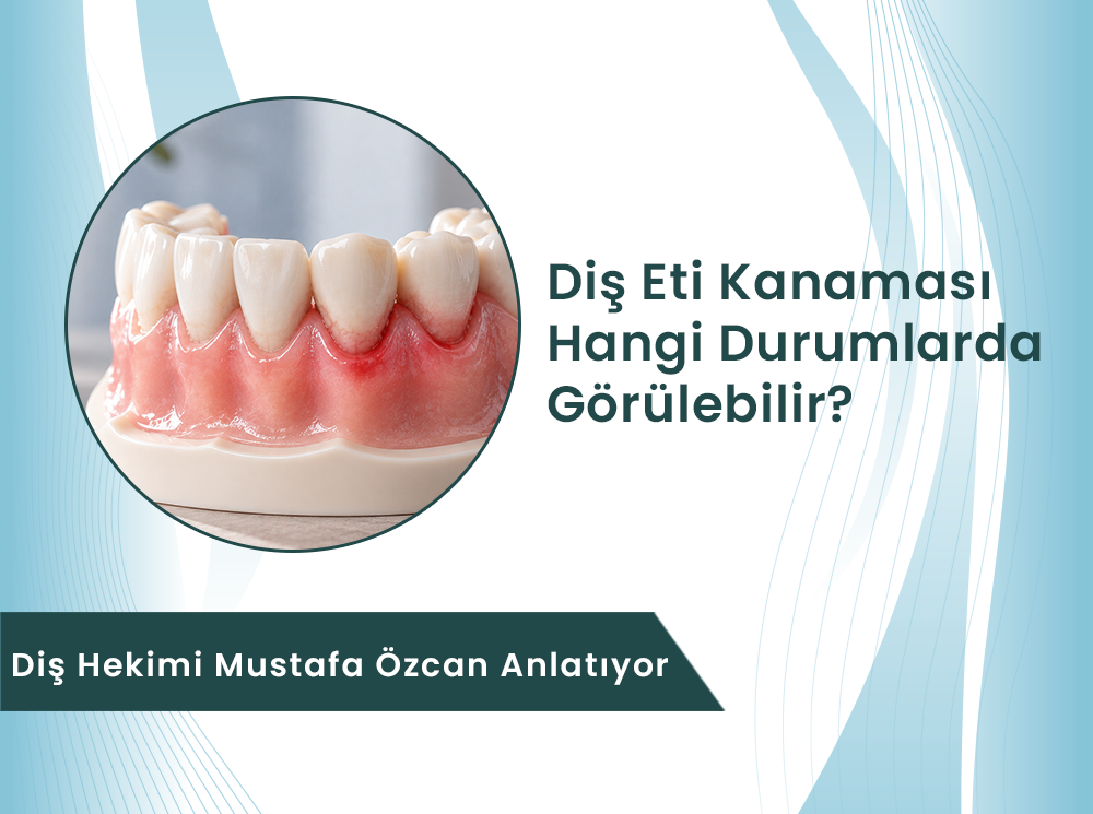 Diş Eti Kanaması Neden Olur?